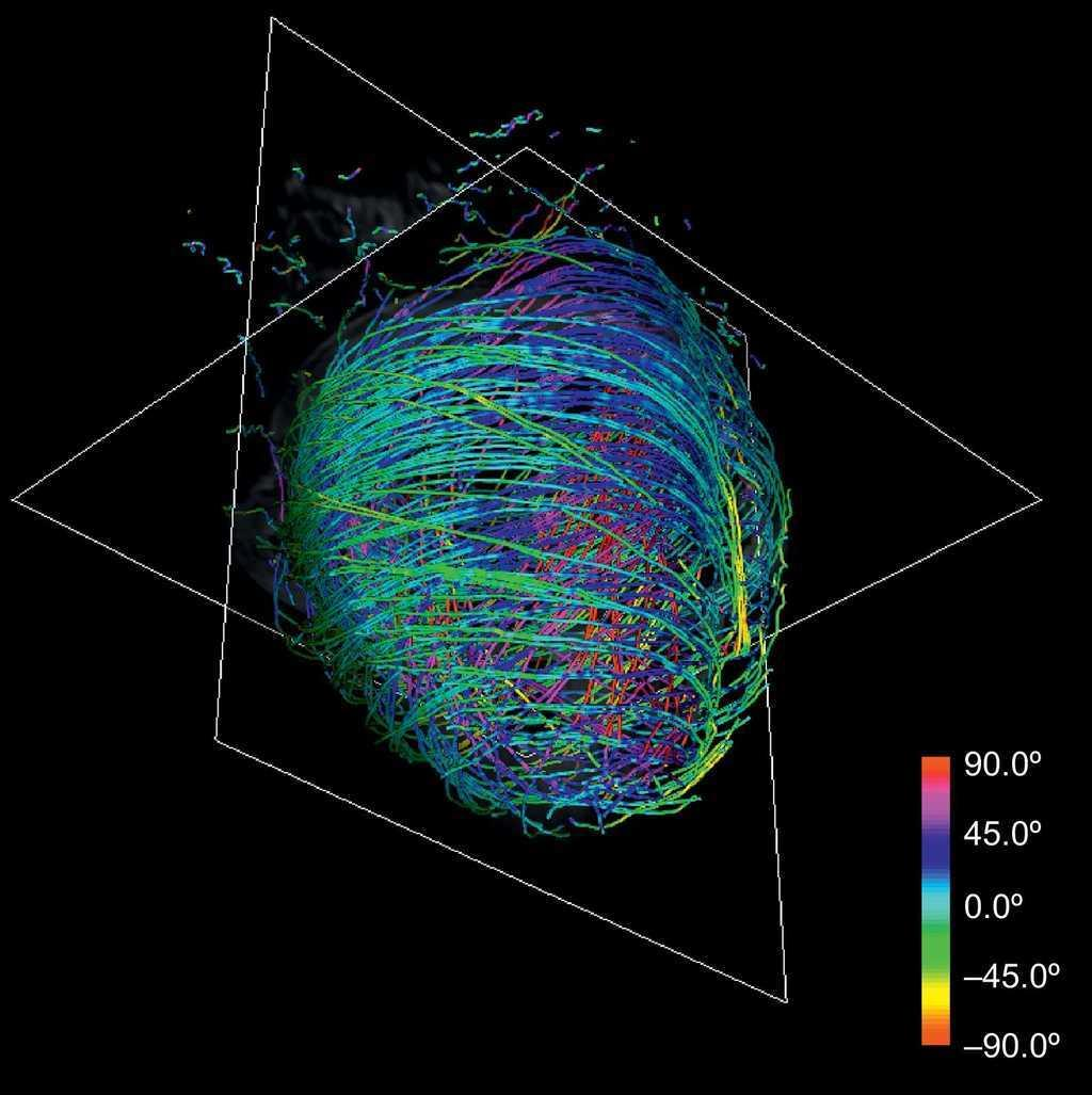 hier fehlt das Bild des helikalen Aufbau des Herz