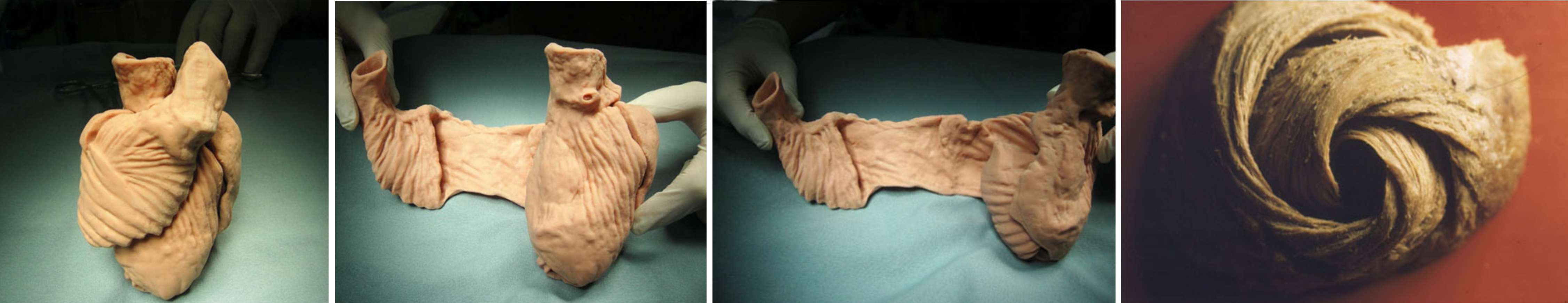 hier fehlt das Bild des helikalen Aufbau des Herz