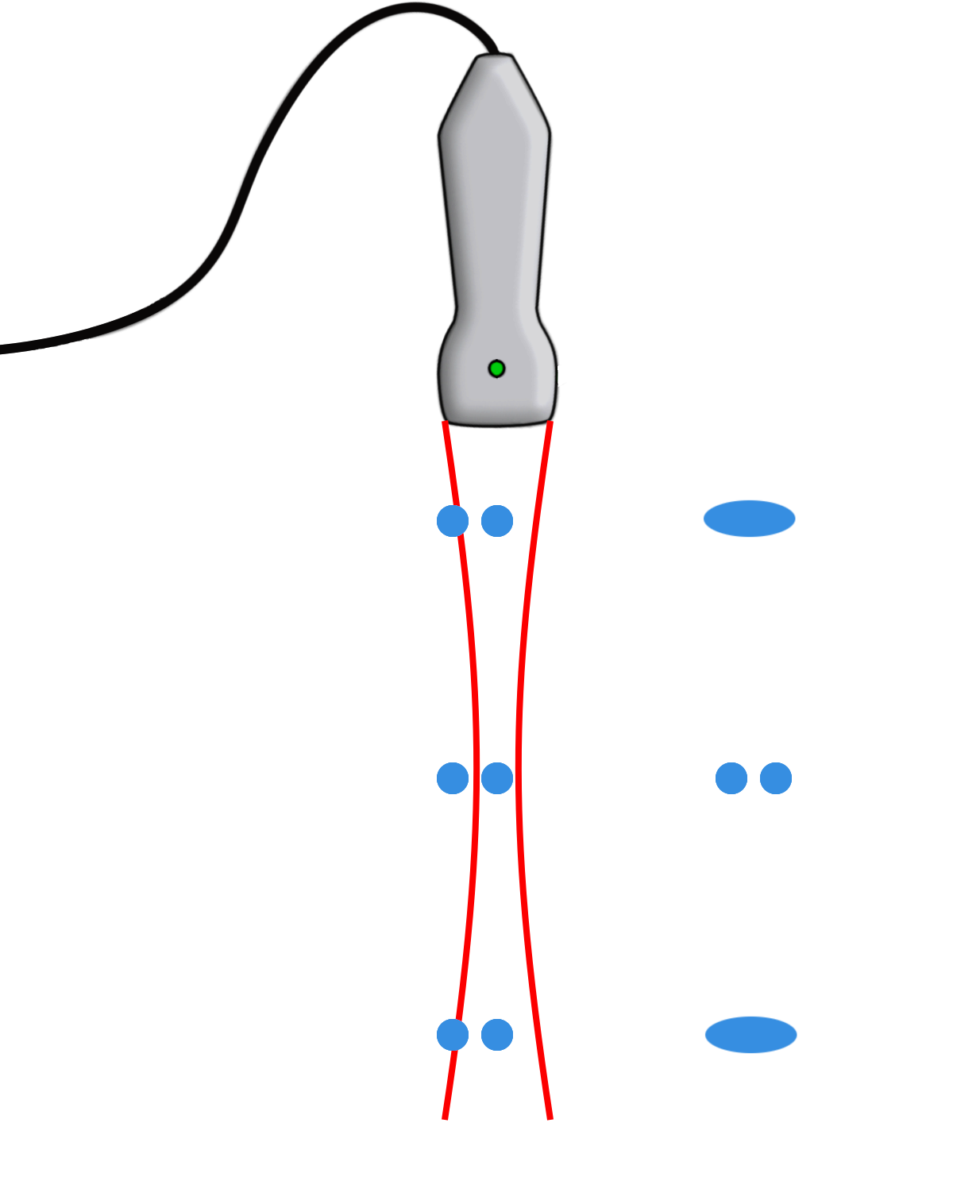 Auflösungsartefakte