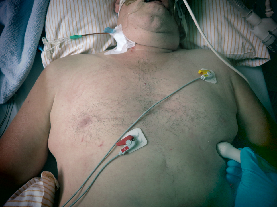 apikale Schnittebene